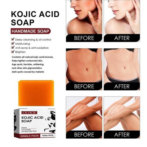 OUHOE DEEP CLEANSING/BRIGHTENING & MOISTURIZING KOJIC ACID SOAP PRICE: #5,500 PRODUCT DESCRIPTION: • Bleaching Oil Control • ⁠Brightenings & Moisturizings • ⁠Deep Cleaning Kojic Acid Soap • ⁠Removes Dark Skin & Fades Melanin • ⁠Anti-Acne & Shrinks Pores Kojic Acid Before And After, Kojic Acid Soap, Deep Cleansing Oil, Face Care Routine, Keratosis Pilaris, Acne Solutions, Acne Care, Kojic Acid, Shrink Pores