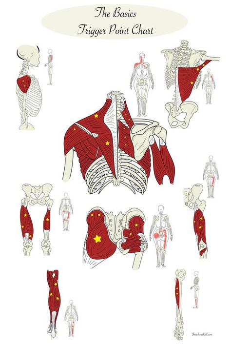 Unlock Your Energy Potential with Acupressure Mat Techniques. Discover how to refresh your mood and vitality. Read here for insights. 👆 Click the link Muscle Anatomy Art, Punkty Spustowe, Neuromuscular Therapy, Physical Therapy Student, Human Muscle Anatomy, Massage Therapy Techniques, Sports Therapy, Trigger Point Therapy, Therapist Office