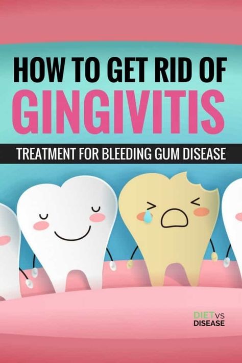 Swollen Gums Remedy, Homemade Mouthwash, Gum Inflammation, Heal Cavities, Swollen Gum, Teeth Whitening Diy, Teeth Health, Receding Gums, Gum Health