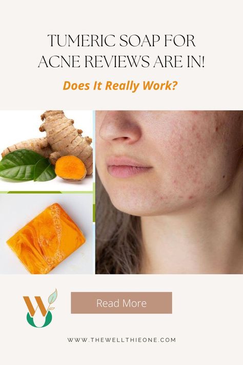 Tumeric Soap For Acne Reviews Are In! Does It Really Work? Clear Up Acne, Turmeric Mask, Turmeric Soap, Ancient Egyptians, Ayurvedic Medicine, Natural Health, Health And Wellness, Medicine, Soap