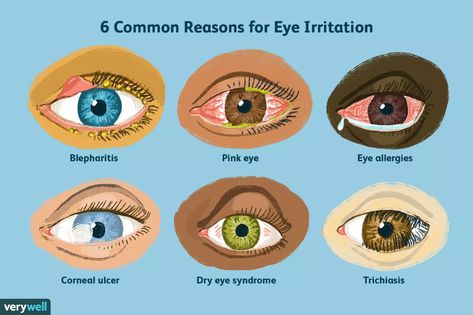 Eye Irritation Remedies, Eyelash Growth Cycle, Eye Health Facts, Pinkeye Remedies, Eye Facts, Plant Lights, Basic Anatomy And Physiology, Parts Of The Eye, Drawing Eye