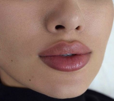 Lip Fillers Juvederm, Lips Inspiration, Face Fillers, Botox Lips, Cheek Fillers, Facial Fillers, Facial Aesthetics, Lip Filler, Botox Fillers