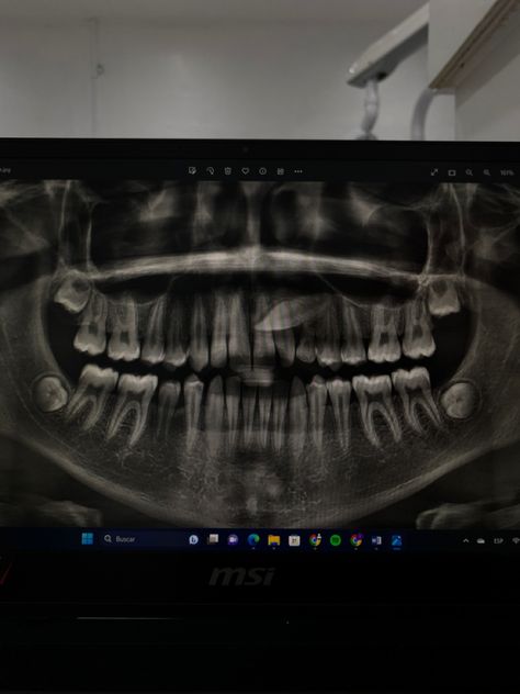 Dental Vision Board, Black Dental Hygienist Aesthetic, Dental Xrays, Dentistry Aesthetic, Dental Hygienist School, Dental Quotes, Aesthetic Dentistry, Dental Technician, Vision Board Images