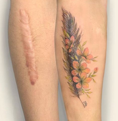 A Vietnamese Artist Uses Her Magical Touch to Help People Regain Self-Confidence by Covering Their Scars With Art Arm Lift Scar Tattoo Cover Up, Scars Tattoo, Cover Up Tattoos For Women, Knee Tattoos, Tattoo Over Scar, Think Tattoo, Scar Cover Up, Tattoos To Cover Scars, Scar Tattoo