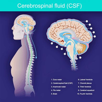 Cerebral Spinal Fluid, Intracranial Pressure, Sensory Nerves, Spinal Fluid, Spinal Nerve, Cerebrospinal Fluid, Fatigue Syndrome, Chronic Disease, Chronic Fatigue