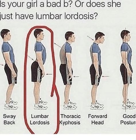 Lumbar Lordosis, Funny Kid Memes, Funny Memes About Life, Crazy Text, Hip Pain, Stay Woke, Shoulder Workout, Sciatica, Upper Body Workout