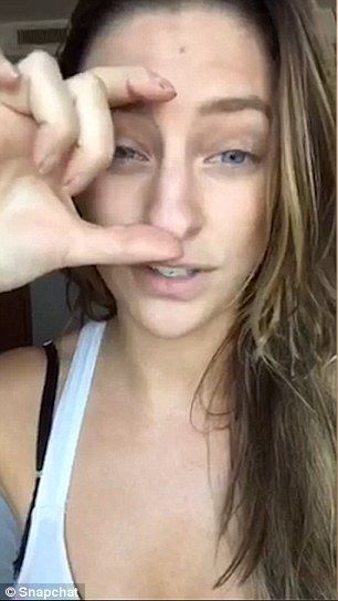 Rhiannon Langley sharing her nose job 'journey' with social media Nose Job Thick Skin, Nose Job In Turkey, Beyonce Nose Job, Celebrity Nose Jobs Before After, Bad Nose Jobs, Cute Display Pictures For Whatsapp, Droopy Tip Nose Rhinoplasty, Swollen Face, Nose Jobs