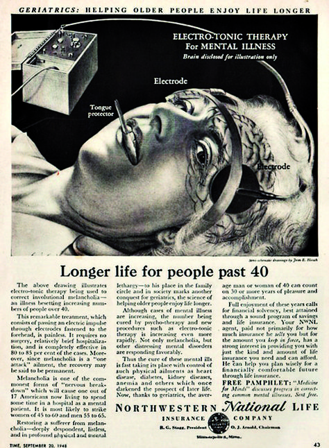 Electric Shock Therapy, Shock Therapy, Weird Vintage, Life Insurance Companies, Old Advertisements, Vintage Medical, Medical Practice, Electric Shock, Old Ads