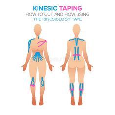 K Tape, Kt Tape, Black Cube, Kinesio Taping, Sports Therapy, Sports Tape, Kinesiology Taping, Free Illustration, Female Body