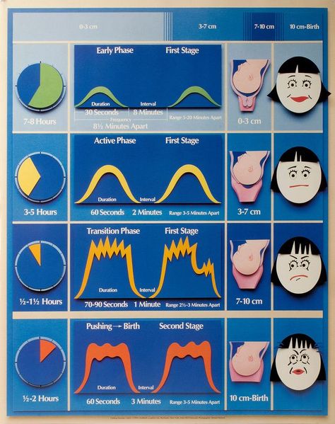 Midwifery Student, Child Nursing, Labor Delivery Nursing, Stages Of Labor, Labor Nurse, Nursing Mnemonics, Pregnancy Labor, Childbirth Education, Birth Doula