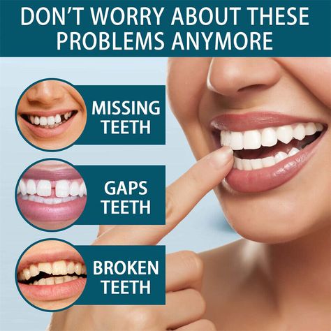 Imperfect Teeth, Teeth Correction, Teeth Covers, Temporary Tooth, Veneers Teeth, Bad Teeth, Dental Fillings, False Teeth, Gap Teeth