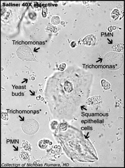 Microscopic exam of Urine Medical Lab Technician, Vet Tech School, Vet Tech Student, Medical Laboratory Technician, Microbiology Lab, Medical Laboratory Scientist, Clinical Chemistry, Laboratory Technician, Vet Medicine