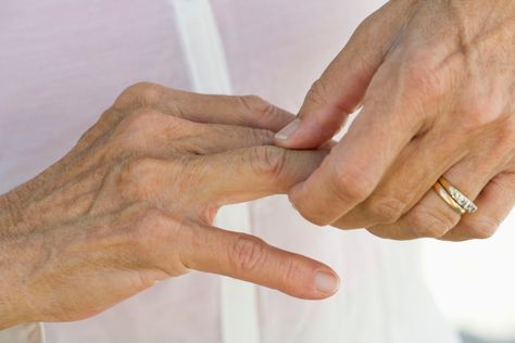 Arthritis in the fingers can cause stiffness, loss of mobility, and pain. Learn about at-home and medically supervised treatments. Finger Injury, Arthritic Pain, Hand Pain, Natural Pain Relief, Knee Pain, Pain Relief