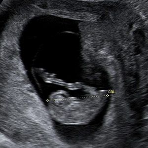 My Pregnancy Calendar (via Parents.com) Human Circulatory System, Trimester By Weeks, Pregnancy Images, Pregnancy Calendar, Early Pregnancy Signs, Pregnant Baby, Ultrasound Pictures, Pregnancy Hormones, Fetal Development