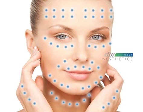 full face mesotherapy Eye Rejuvenation, Face Injections, Botox Injection Sites, Injection Sites, Botox Injection, Aesthetic Dermatology, Facial Anatomy, Skin Facts, Facial Fillers