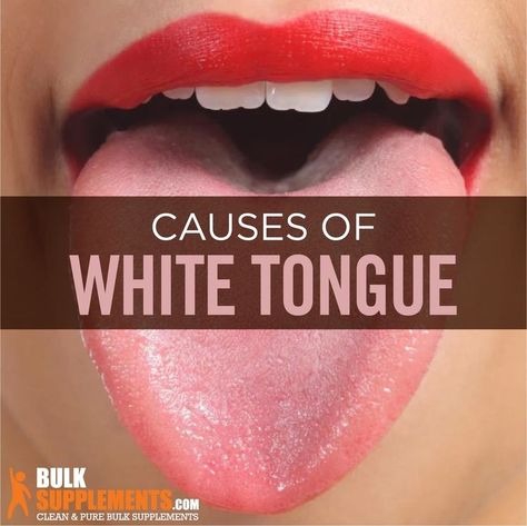 Tongue Health Chart, Tongue Color Meaning, How To Get Rid Of White Tongue, White Tongue Causes, White Coated Tongue, Tongue Problems, Clean Tongue, Tongue Thrust, Tongue Cleaning