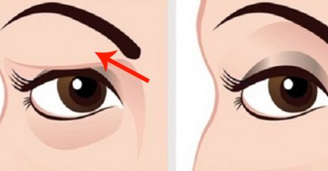 plus.google.com share?url=http: Saggy Eyelids, Sagging Eyelids, Drooping Eyelids, Droopy Eyelids, Droopy Eyes, Eye Exercises, Organic Remedy, Makijaż Smokey Eye, Beauty Remedies