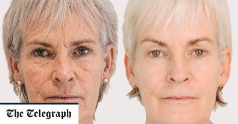 Why your neck is an ageing giveaway – and what you can do to solve it Jamie Murray, Facelift Procedure, Non Surgical Facelift, Face Lift Surgery, Skin Tightening Treatments, Turkey Neck, Crepey Skin, Midlife Women, Skin Clinic