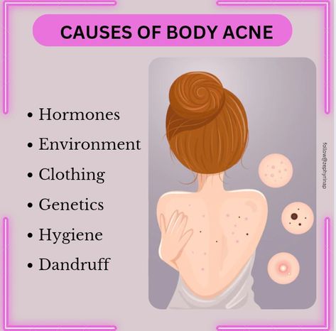 Back Acne Remedies, Facial Massage Techniques, Blind Pimple, Back Acne, Pimples Under The Skin, Body Acne, Wax Strips, Skin Pores, Massage Techniques