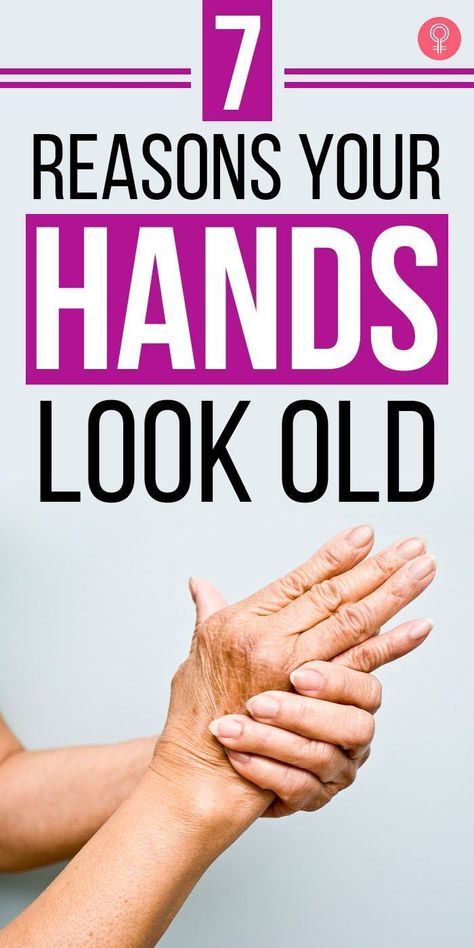 7 Reasons Your Hands Look Old: You have to devote as much time to taking care of the delicate, overused skin of your hands as you do of your face. Here are 7 things that give your hands an aged appearance and what you can do to fix them. #hands #skin #skincare #old #beauty #beautytips Remove Super Glue, Natural Wrinkle Remedies, Wrinkles Hands, Wrinkle Remedies, Wrinkle Free Skin, Get Rid Of Warts, Face Wrinkles, Wrinkled Skin, Anti Aging Tips