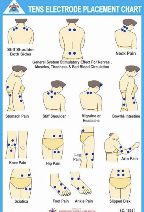 Tens Electrode Placement, Tens Unit Placement, Forward Head Posture Exercises, Tens And Units, Tens Machine, Cupping Massage, Massage Therapy Techniques, Ten Unit, Kinesiology Taping