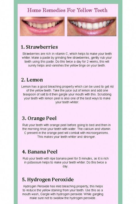 White Teeth Tips, Get Whiter Teeth, Teeth Whitening Diy, Yellow Teeth, Stronger Teeth, Oral Care Routine, Natural Teeth Whitening, Natural Teeth, Teeth Care