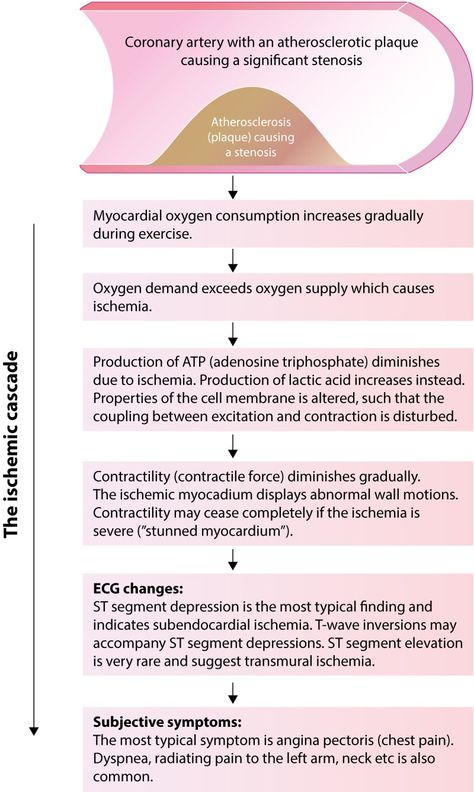 Myocardial Ischemia, Acute Coronary Syndrome, Angina Pectoris, Cardiac Nursing, Exercise Physiology, Coronary Arteries, Autonomic Nervous System, Cell Membrane, Nursing Notes