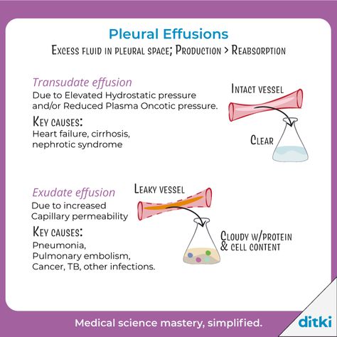 What are some signs/symptoms of pleural effusion?   Learn more: https://ditki.com/course/pathology/respiratory-pathologies/restrictive-diseases/1653/misc-restrictive-disorders-pleural-effusions-ankylosing-spondylitis-kyphoscoliosis   #ditki #usmle #meded #medschool #medstudent #highered #pathology #pleura #respiratorypath #nursing #pance #physicianassistant #osteopath #allopath #medicine #science #healthscience #nurse #premed #mcat #mbbs Sympathetic Vs Parasympathetic Pharmacology, Anticholinergic Mnemonic, Pneumonia Pathophysiology, Pentose Phosphate Pathway Mnemonic, Pleural Effusion Nursing, Pleural Effusion, Pre Med, Physician Assistant, Med Student