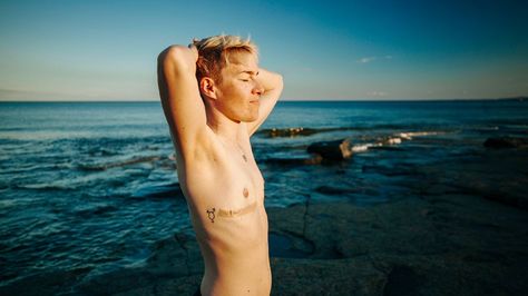 Your Guide to Nonbinary Top Surgery Options Top Surgery Results, Nickelodeon Cast, Nonbinary People, Top Surgery, Trans Community, Breast Reduction, Breast Augmentation, Child Actors, Human Services