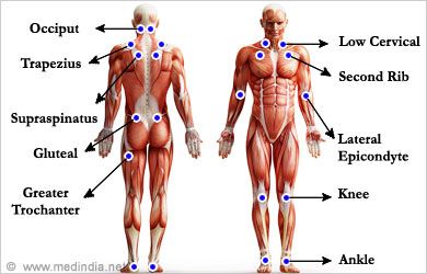 Myofascial Pain Syndrome: Fibromyalgia Myofascial Pain Syndrome, Referred Pain, Chronic Pain Management, Neck Problems, Trigger Point Therapy, Myofascial Release, Trigger Points, Healthy Lifestyle Tips, Body Love