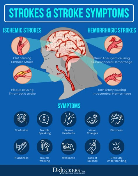 Cerebrovascular Disease: Causes, Symptoms & Solutions - DrJockers.com Dizziness Causes, Types Of Strokes, Neurological Disorders, Medical Knowledge, Disease Prevention, Sciatica, Health Info, Health Facts, Brain Health