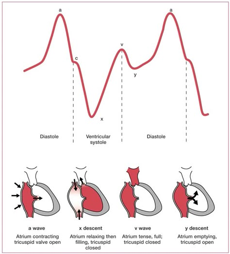 Cath Lab Nursing, Central Venous Pressure, Medications Nursing, Cardiac Sonography, Cardiology Nursing, Cardiac Cycle, Medical Library, Philip Roth, Cardiac Nursing