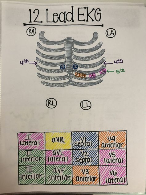 Medical Assistant School, Emt Study, Medical Assistant Student, Paramedic School, Student Notes, Nurse Study Notes, Nursing Mnemonics, Medical Student Study, Nursing School Survival