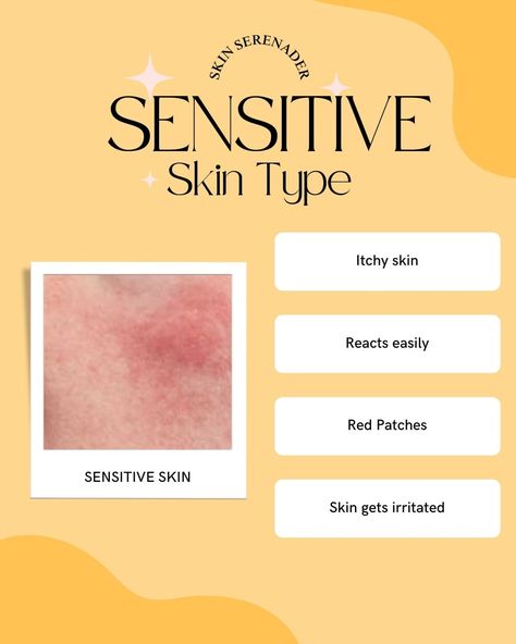 Discover Your Skin Type for Flawless Skin! ✨ Not sure if you have oily, dry, combination, or sensitive skin? Swipe through this ultimate skin type guide to find out and get personalized skincare tips for a radiant complexion! 🌟 #skintype #skincareroutine . . . . . #skintypeguide #howtoknowyourskintype #skincaretips #skincareforyourhair #knowyourskin #glowingskin #healthyskin #beautytips #skincareroutine #selfcaresunday #skincareessentials #complexionperfection #beautyroutine #skincarecommu... Wedding Skincare, Skincare 101, Perfect Complexion, Itchy Skin, Skincare Tips, Face Skin Care, Flawless Skin, Skin Care Essentials, Skin Care Regimen