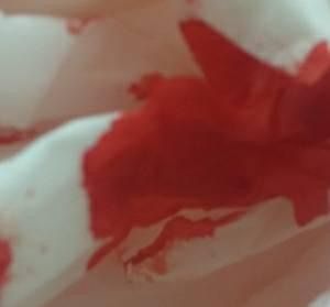 Mestrasion Blood Pad, Mestral Pad Blood, Pap Batuk Darah, Blood Tissue Snapstreaks, Nose Bleeds Fake Photo, Period Blood In Toilet, Disney Expressions, Working Pictures, Menstrual Blood