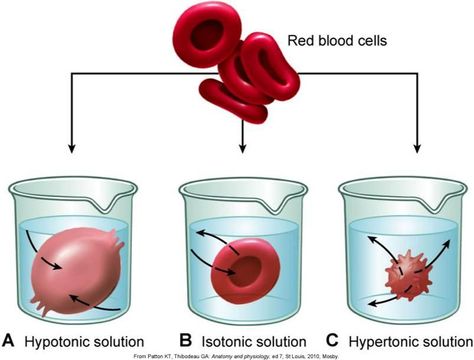 There are three types of osmosis hypotonic, hypertonic, and isotonic. These are the effects of different solutions on blood cells. This picture is of the osmotic pressures on blood cells. Osmotic Pressure, Study Biology, Biology Classroom, Basic Anatomy And Physiology, Medical Laboratory Science, Study Flashcards, Chemistry Lessons, Biology Lessons, Medical School Studying