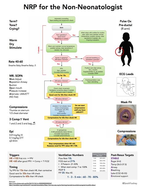 Neonatal Resuscitation Program (NRP) for the Non-NeonatologistMR. ... Neonatal Resuscitation Cheat Sheet, Pediatric Respiratory Therapist, Newborn Resuscitation, Nicu Nurse Education, Neonatal Resuscitation, Clinical Instructor, Obstetrics Nursing, Neonatal Nurse Practitioner, Nicu Nursing