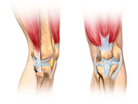 Patellar Tracking Disorder, Anatomy Of The Knee, Cutaway Illustration, Human Joints, Knee Fat, Joints Anatomy, Human Knee, Knee Ligaments, Anatomy Images