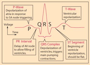 Electrocardiograms Ekg Interpretation, Pr Interval, Paramedic School, Nursing Mnemonics, Medical Student Study, Cardiac Nursing, Nursing School Survival, Critical Care Nursing, Endocannabinoid System