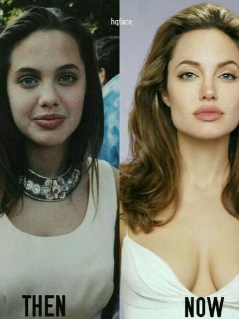 Did Angelina Jolie ever say anything about plastic surgery? Angelina Jolie Surgery, Angelina Jolie Nose, Angelina Jolie Plastic Surgery, Celebs Without Makeup, Angelina Jolie Photos, Celebrities Then And Now, Celebrity Plastic Surgery, Celebrities Before And After, After Photos