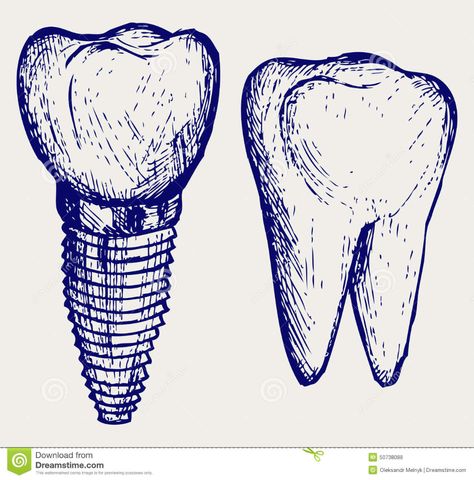 Tooth Outline, Tooth Icon, Dental Anatomy, Medical Posters, Lab Logo, Teeth Implants, Dental Art, Icon Set Vector, Line Art Drawings