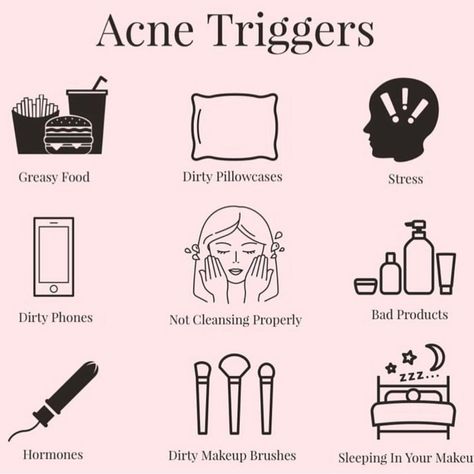 Acne Triggers, Skin Facts, Acne Tips, Skin Advice, Esthetician Room, Basic Skin Care, Acne Causes, Good Skin Tips, Basic Skin Care Routine