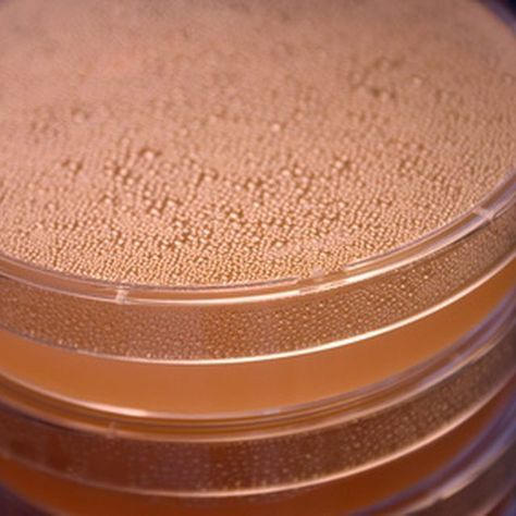 How To Make Agar For Petri Dishes, Diy Petri Dish, Petri Dish Photography, Bacteria Petri Dish, College Teaching, Paper Cup Crafts, Mushroom Spores, Science Fair Project, Diy Dish