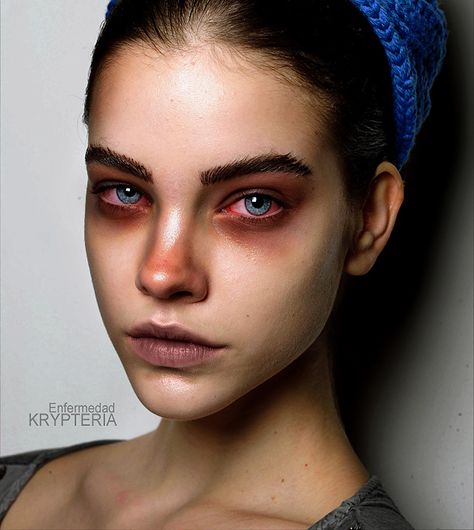 The bloodshot eyes is a really nice touch. Zombie Halloween Makeup, Zombie Eyes, Angry Girl, Angry Women, Zombie Makeup, Stage Makeup, Zombie Halloween, Sfx Makeup, Face Photography