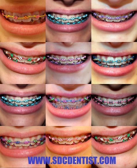 Braces Dentist, Braces Retainer, Cute Braces Colors, Braces Tips, Getting Braces, Cute Braces, Brace Face, Teeth Whitening Diy, Braces Colors