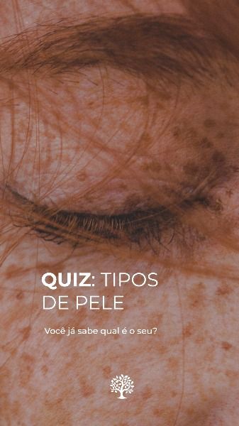 Quiz para tipos de pele Nail Studio, Story Instagram, Esthetician, Instagram Feed, Anatomy, Facial, Spa, Acne, Social Media