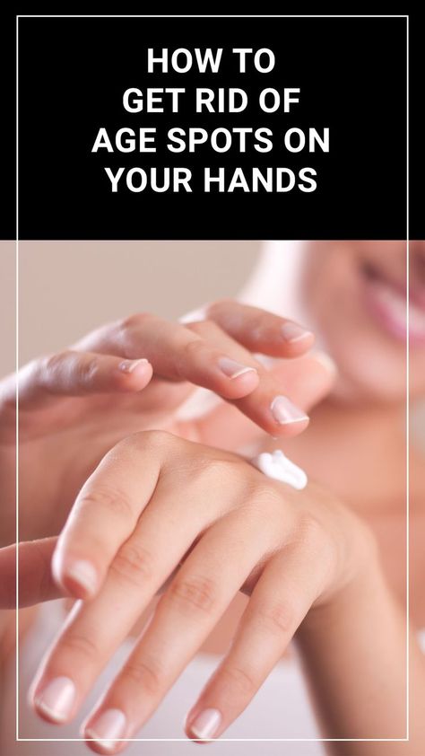 To get rid of age spots on your hands here are some of the processes you can try. Age Spots On Hands, Get Rid Of Age Spots, Remove Skin Tags Naturally, Age Spot Removal, Baking Soda For Hair, Tips For Oily Skin, Dark Spots On Face, Skin Natural Remedies, Natural Sleep Remedies