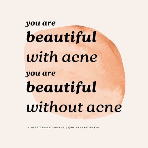 You are beautiful. Do you need to hear this today? Say it with me: I am beautiful with acne. I am beautiful without acne 🥰 I’m here to help you truly feel this way. Acne is a symptom. A symptom our brain 🧠 loves to focus on. Our brains, they’re crafty. They love zeroing in on anything different from the norm. Your body’s way of protecting you 🤗 Next, your brain starts putting thoughts to this focus like… I’m ugly I hate my skin I’m going to be stuck with acne forever When you notice ... Acne Quotes Motivation, Acne Quotes, Acne Positivity, Acne Help, Cystic Acne, I Am Beautiful, Acne Skin, Reminder Quotes, Self Motivation