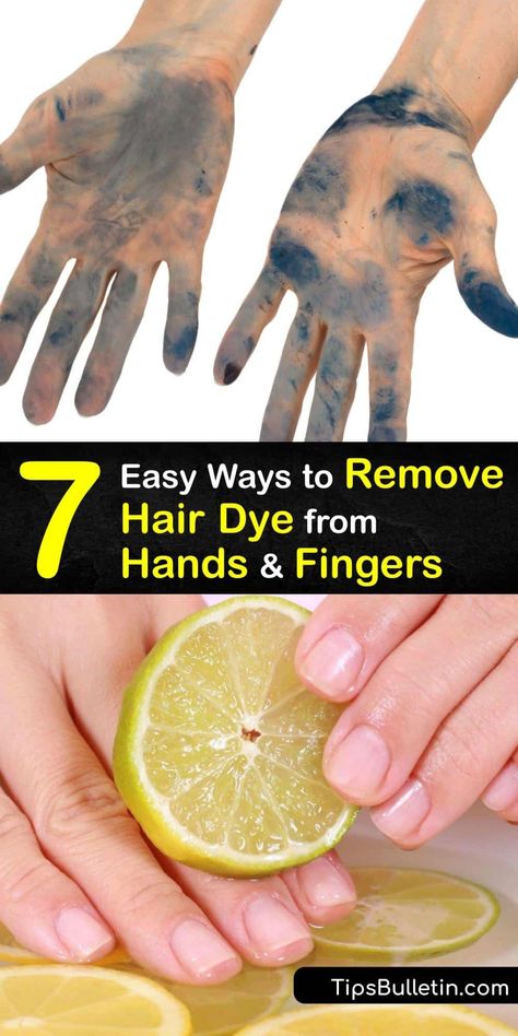 Find out how to get rid of a hair dye stain on your skin with lemon juice, olive oil, or rubbing alcohol. Permanent hair dye is hard to get off, but not impossible. Next time you use hair color, apply petroleum jelly to your hairline to prevent a dye stain. #remove #hair #dye #hands #fingers How To Get Rid Of Hair Dye On Skin, How To Dye Hair Without Dye, How To Get Hair Dye Out Of Skin, How To Remove Hair Dye From Skin, Remove Semi Permanent Hair Color, Diy Hair Dye Remover, Removing Black Hair Dye, Remove Permanent Hair Dye, Remove Hair Dye