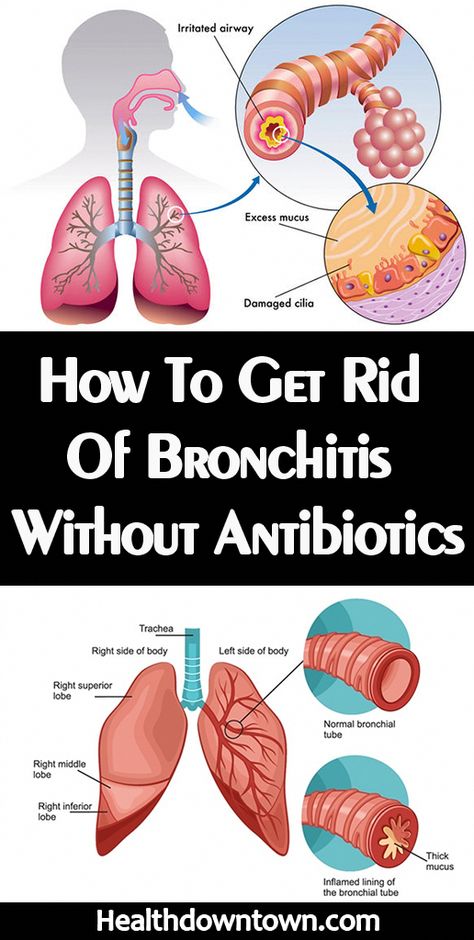 In this video, we unveil the top 10 home remedies to get rid of bronchitis without antibiotics. Say goodbye to bronchitis symptoms with these natural remedie... Remedies For Bronchitis, Home Remedies For Bronchitis, Best Cough Remedy, Top 10 Home Remedies, Chronic Cough, Sinus Congestion, Natural Sleep Remedies, Natural Antibiotics, Increase Energy